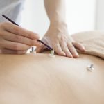 Traditional Moxibustion Warming Therapy